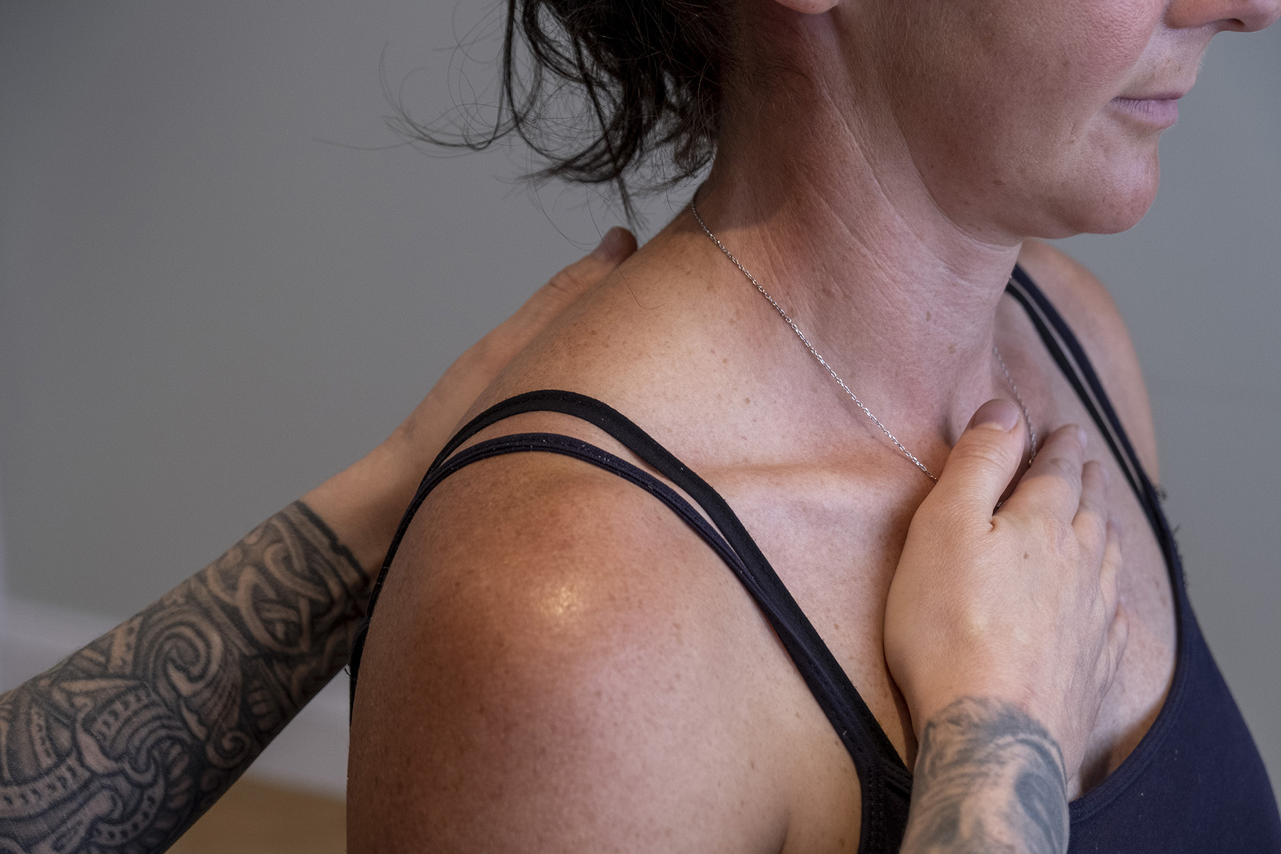 Hypermobility Physiotherapist
